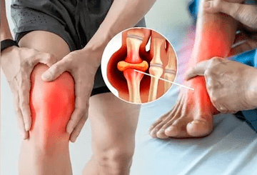 Icexin gelio tepimo kelio sąnario ir pėdos srityje schema